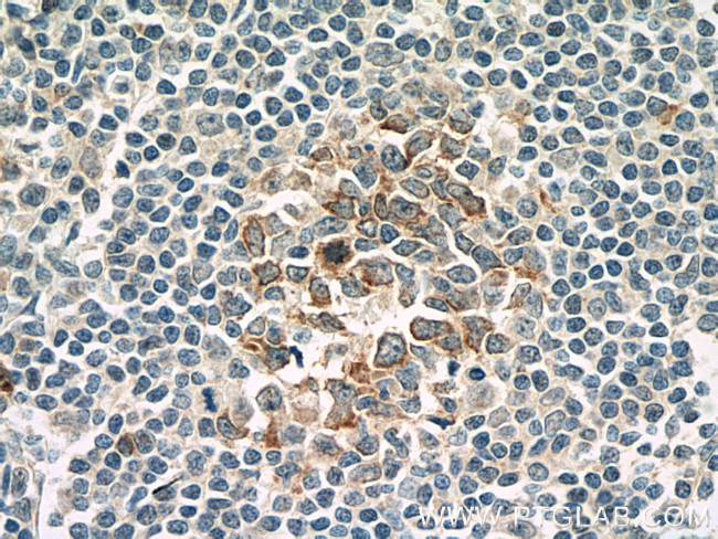 IL21R Antibody in Immunohistochemistry (Paraffin) (IHC (P))