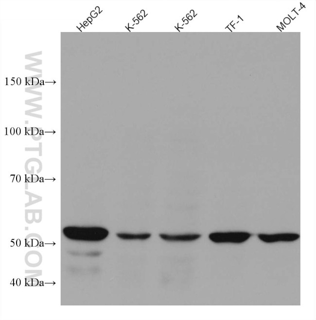 IL21R Antibody in Western Blot (WB)