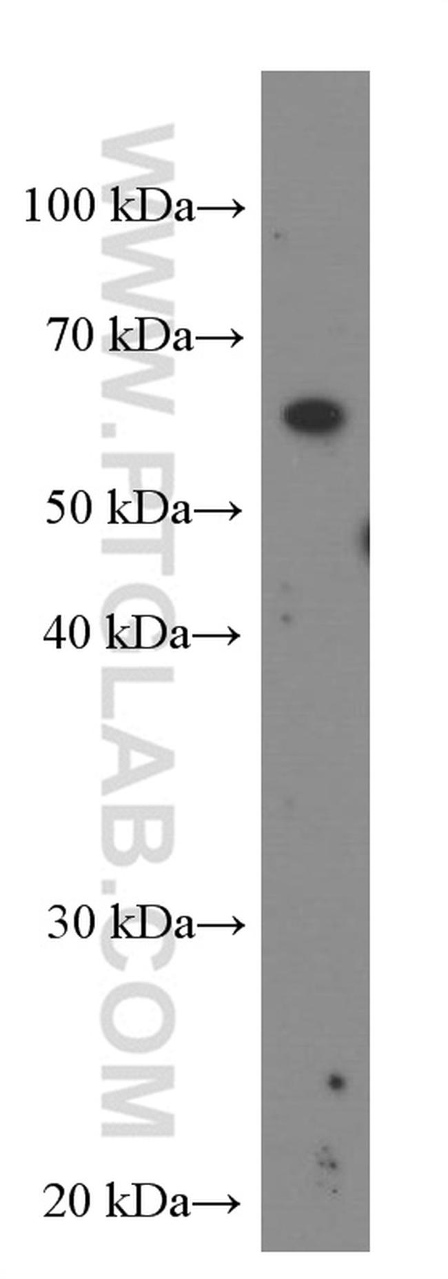 IL21R Antibody in Western Blot (WB)