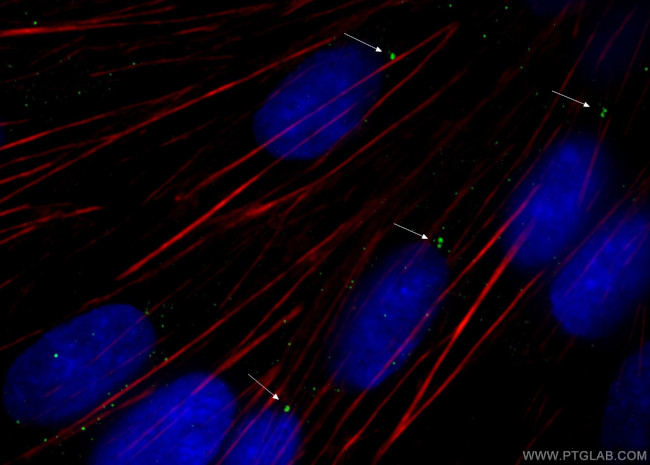 gamma tubulin Antibody in Immunocytochemistry (ICC/IF)