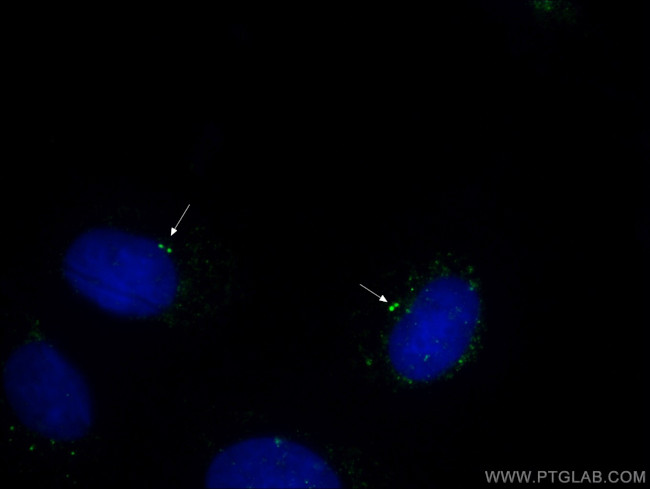 gamma tubulin Antibody in Immunocytochemistry (ICC/IF)