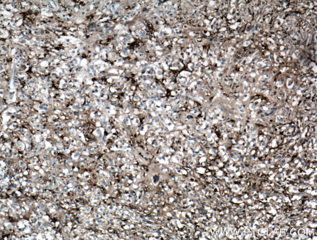 gamma tubulin Antibody in Immunohistochemistry (Paraffin) (IHC (P))