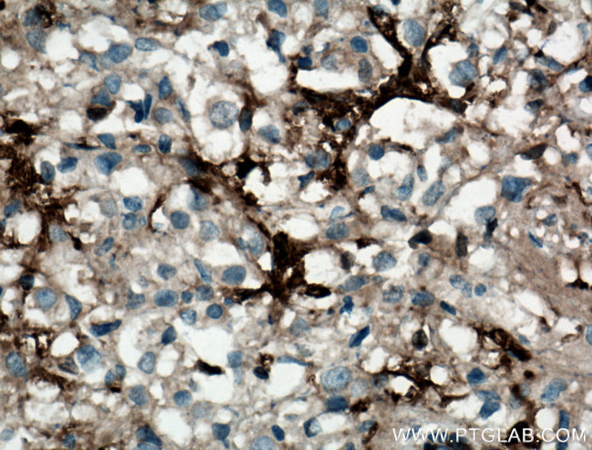 gamma tubulin Antibody in Immunohistochemistry (Paraffin) (IHC (P))