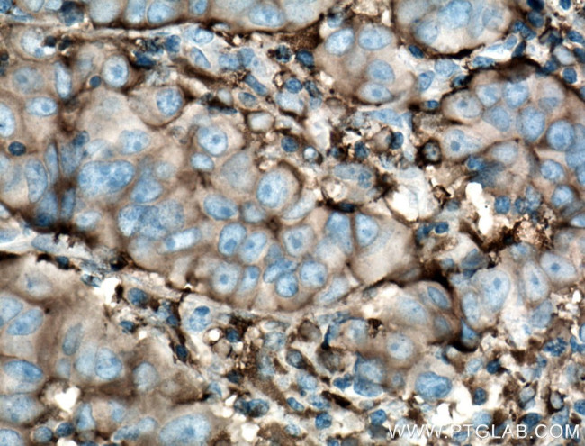 gamma tubulin Antibody in Immunohistochemistry (Paraffin) (IHC (P))