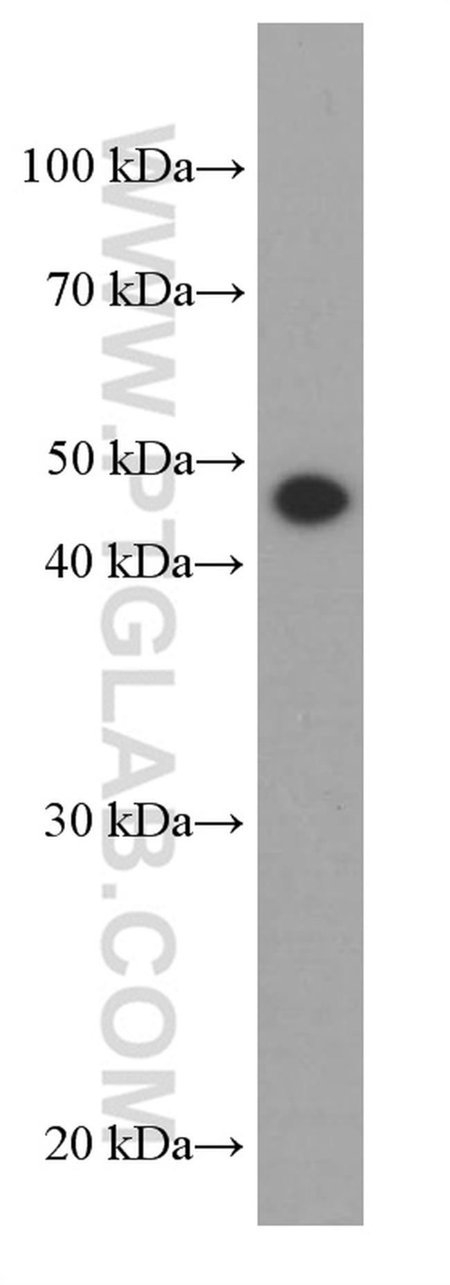 gamma tubulin Antibody in Western Blot (WB)