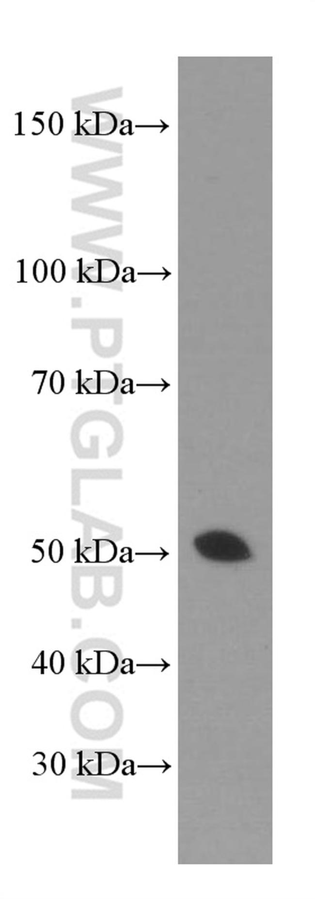 gamma tubulin Antibody in Western Blot (WB)