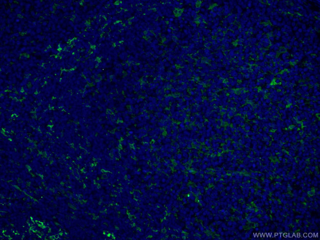 Fascin Antibody in Immunohistochemistry (PFA fixed) (IHC (PFA))