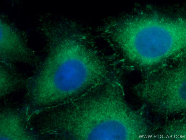 Fascin Antibody in Immunocytochemistry (ICC/IF)