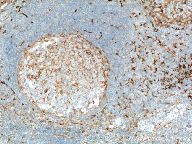 Fascin Antibody in Immunohistochemistry (Paraffin) (IHC (P))