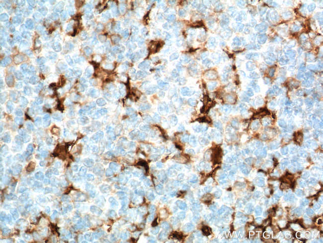 Fascin Antibody in Immunohistochemistry (Paraffin) (IHC (P))