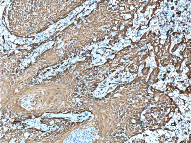 Fascin Antibody in Immunohistochemistry (Paraffin) (IHC (P))