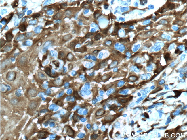 Fascin Antibody in Immunohistochemistry (Paraffin) (IHC (P))