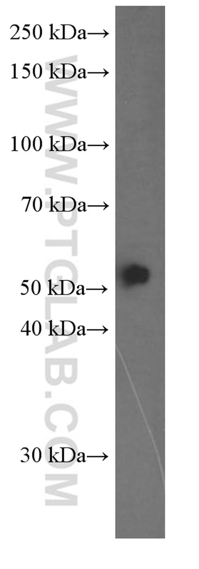 Fascin Antibody in Western Blot (WB)