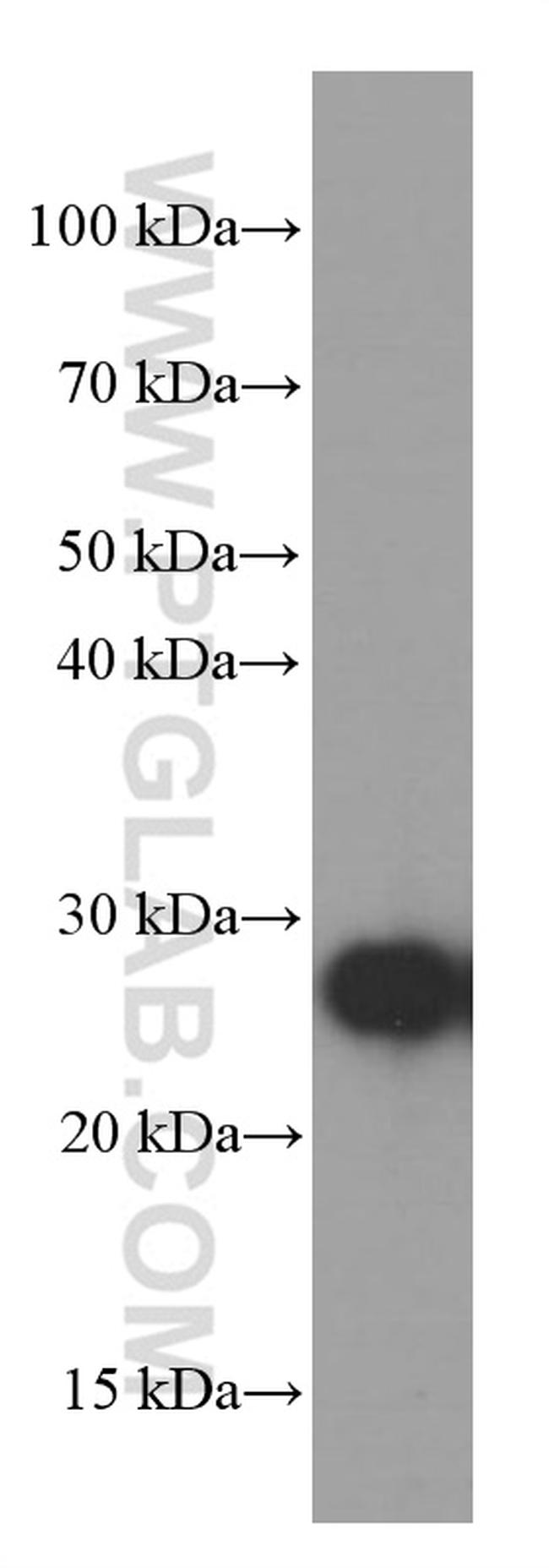 GAMT Antibody in Western Blot (WB)