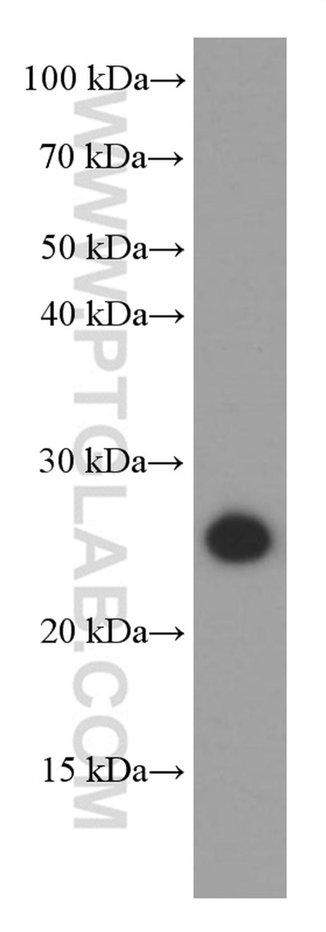 GAMT Antibody in Western Blot (WB)