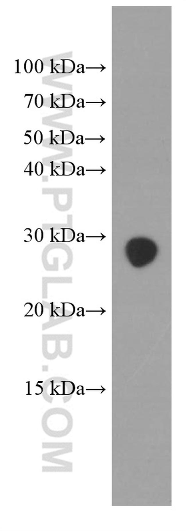 GAMT Antibody in Western Blot (WB)