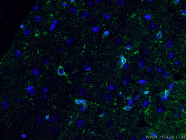 Glutamine synthetase Antibody in Immunohistochemistry (PFA fixed) (IHC (PFA))