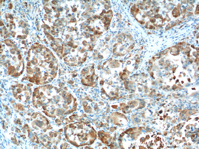 Glutamine synthetase Antibody in Immunohistochemistry (Paraffin) (IHC (P))