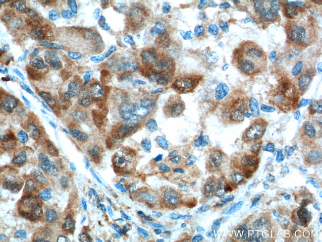 Glutamine synthetase Antibody in Immunohistochemistry (Paraffin) (IHC (P))