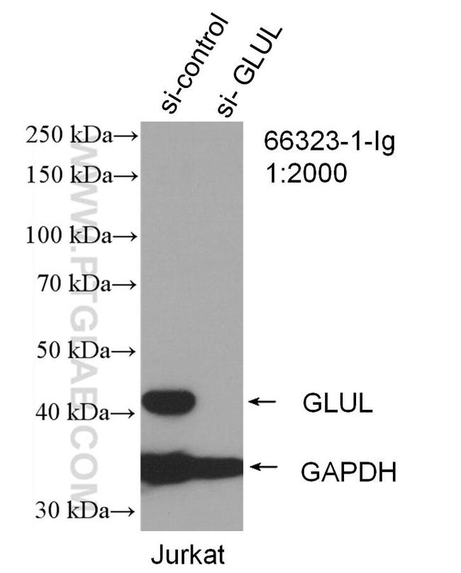 Glutamine synthetase Antibody in Western Blot (WB)