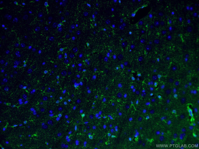 Glutamine synthetase Antibody in Immunohistochemistry (PFA fixed) (IHC (PFA))