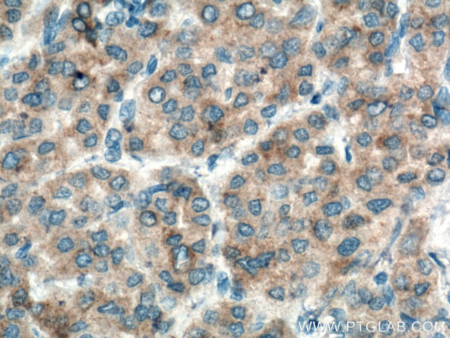 Glutamine synthetase Antibody in Immunohistochemistry (Paraffin) (IHC (P))