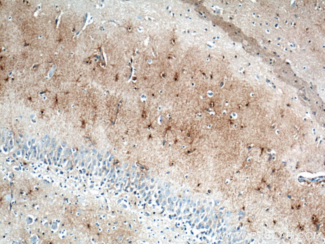 Glutamine synthetase Antibody in Immunohistochemistry (Paraffin) (IHC (P))