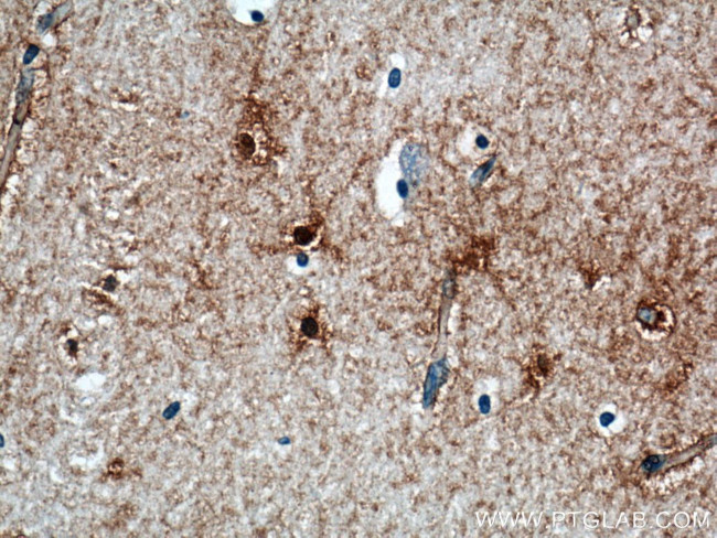 Glutamine synthetase Antibody in Immunohistochemistry (Paraffin) (IHC (P))