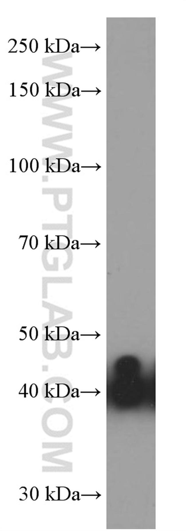 Glutamine synthetase Antibody in Western Blot (WB)