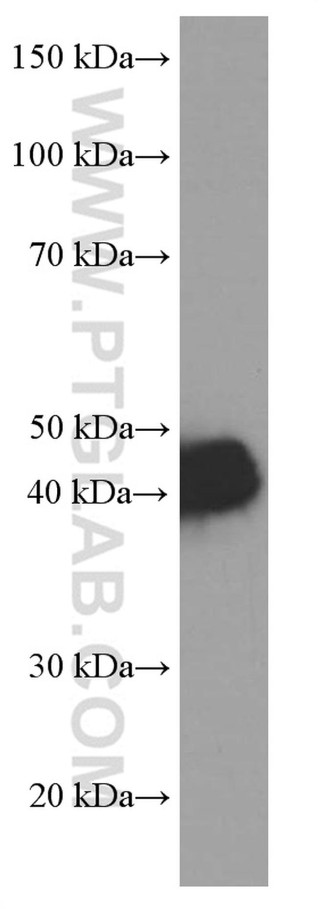 Glutamine synthetase Antibody in Western Blot (WB)