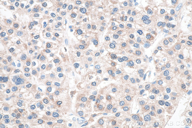 Glutamine Synthetase Antibody in Immunohistochemistry (Paraffin) (IHC (P))