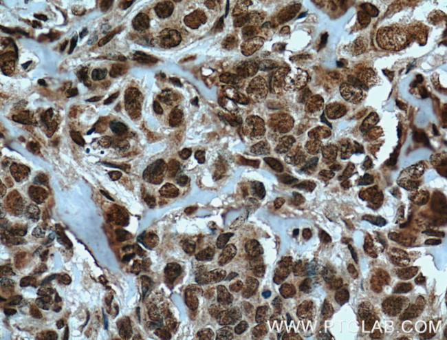 TRIM24 Antibody in Immunohistochemistry (Paraffin) (IHC (P))