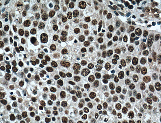 TRIM24 Antibody in Immunohistochemistry (Paraffin) (IHC (P))