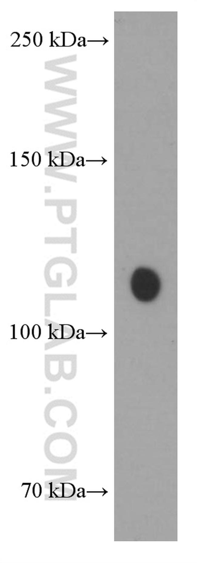 TRIM24 Antibody in Western Blot (WB)