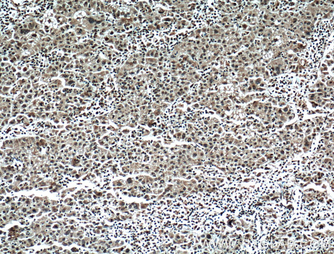 TRIM24 Antibody in Immunohistochemistry (Paraffin) (IHC (P))