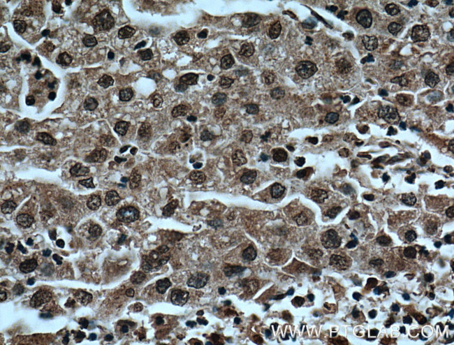 TRIM24 Antibody in Immunohistochemistry (Paraffin) (IHC (P))