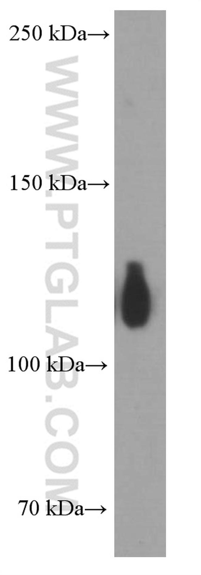 TRIM24 Antibody in Western Blot (WB)