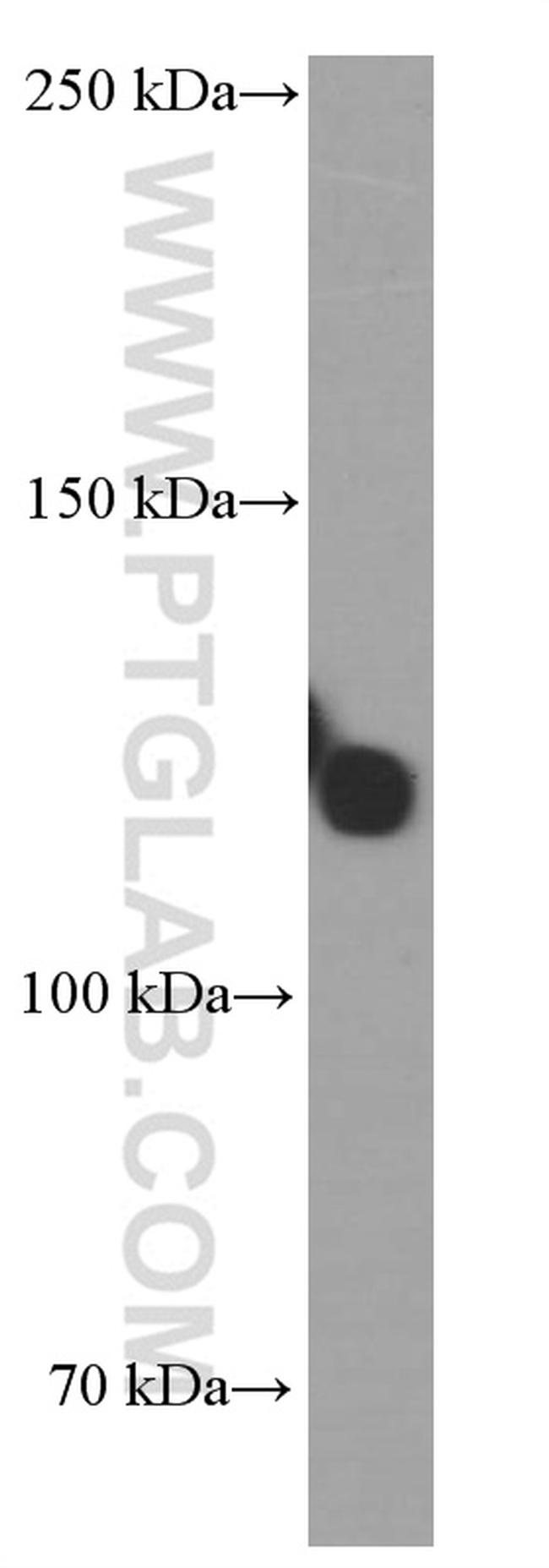 TRIM24 Antibody in Western Blot (WB)