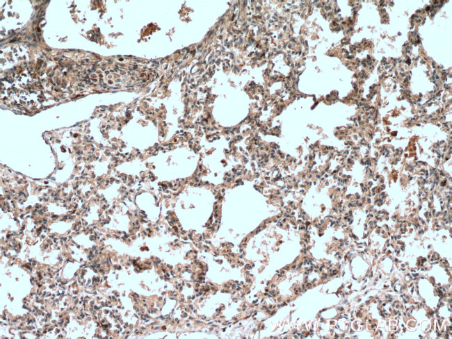 5 Lipoxygenase Antibody in Immunohistochemistry (Paraffin) (IHC (P))