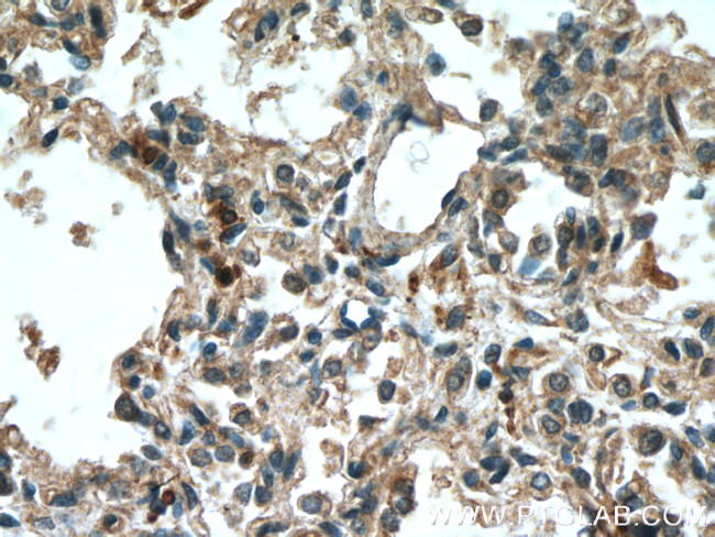 5 Lipoxygenase Antibody in Immunohistochemistry (Paraffin) (IHC (P))