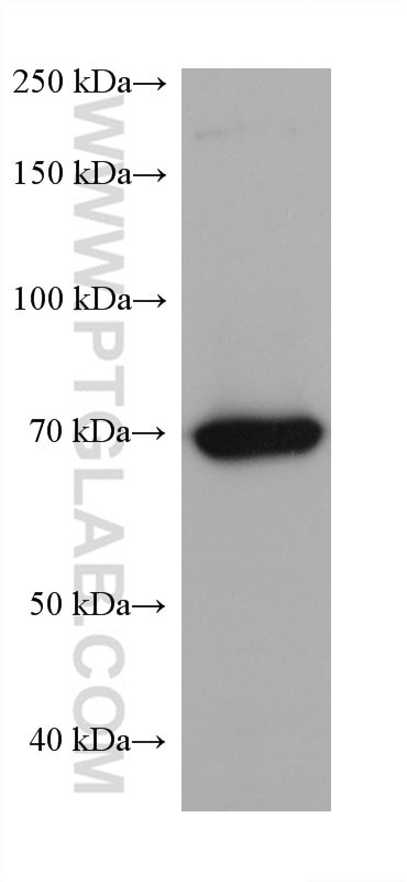 5 Lipoxygenase Antibody in Western Blot (WB)