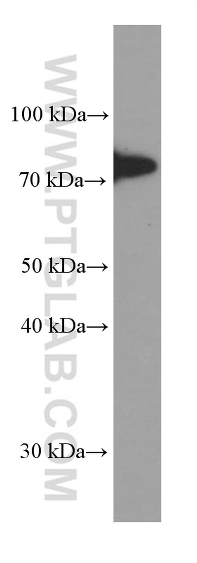 5 Lipoxygenase Antibody in Western Blot (WB)