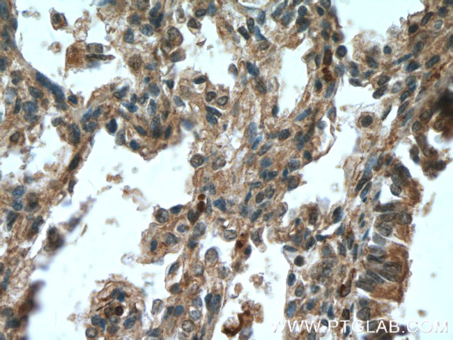 5 Lipoxygenase Antibody in Immunohistochemistry (Paraffin) (IHC (P))