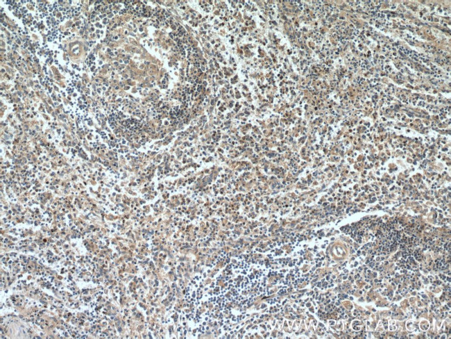 5 Lipoxygenase Antibody in Immunohistochemistry (Paraffin) (IHC (P))