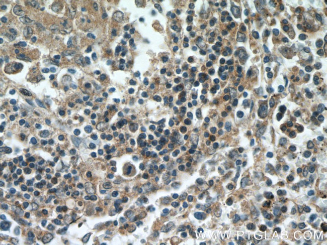 5 Lipoxygenase Antibody in Immunohistochemistry (Paraffin) (IHC (P))