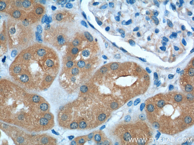 VPS37A Antibody in Immunohistochemistry (Paraffin) (IHC (P))