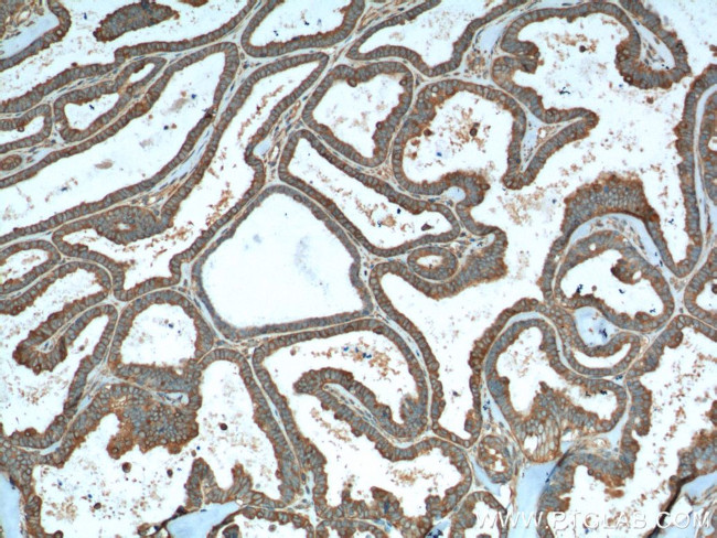 VPS37A Antibody in Immunohistochemistry (Paraffin) (IHC (P))