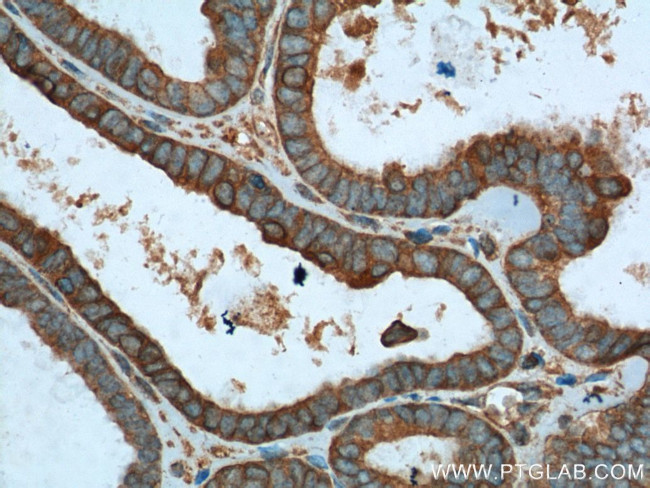 VPS37A Antibody in Immunohistochemistry (Paraffin) (IHC (P))