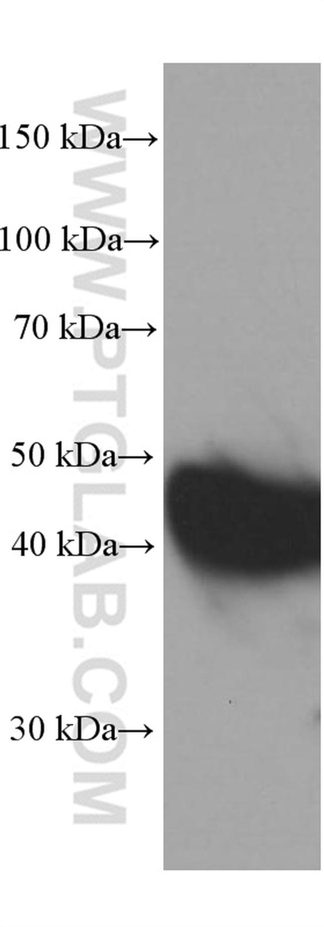 VPS37A Antibody in Western Blot (WB)