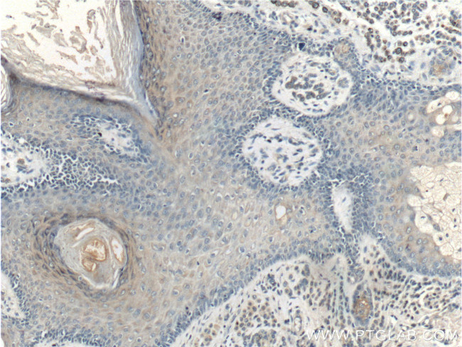 SFRP2 Antibody in Immunohistochemistry (Paraffin) (IHC (P))